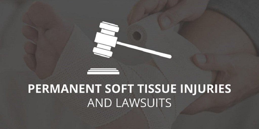Permanent Soft Tissue Injuries & Lawsuits Georgia | Call 678-310-2827 Permanent Soft Tissue Injuries & Lawsuits Georgia | Call 678-310-2827 for free consultation.