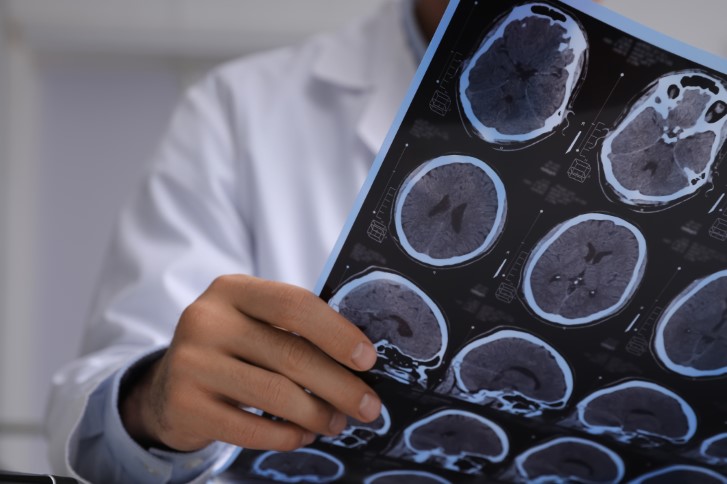 Educate Others About Your Brain Injury in Atlanta, GA | Call 678-310-2827 for free consultation